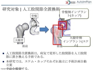 研究対象 | 人工股関節全置換術
                                                 骨盤側インプラン
                                           骨盤      ト(カップ)




                                                     大腿骨側
                         大腿骨                       インプラント(ステ
                                      術前        術後     ム)

        人工股関節全置換術は，病気で変形した股関節を人工股関
         節に置き換える手術である．
        本研究では，ステム・カップそれぞれ独立に手術計画自動
         立案
         手法を提案する．
Copyright © Osaka Univ., Kobe Univ. 2011
 