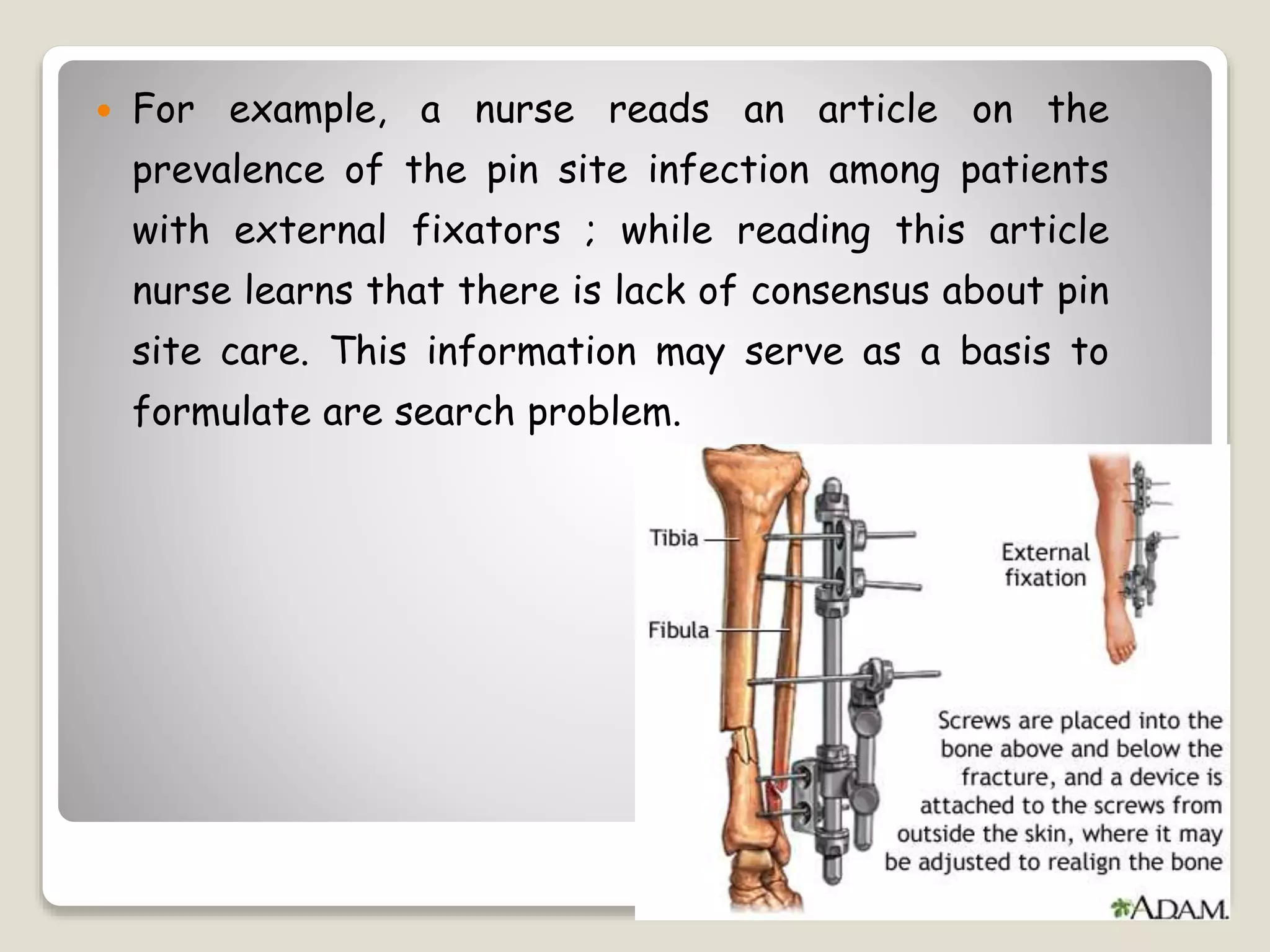  For example, a nurse reads an article on the
prevalence of the pin site infection among patients
with external fixators ; while reading this article
nurse learns that there is lack of consensus about pin
site care. This information may serve as a basis to
formulate are search problem.
 