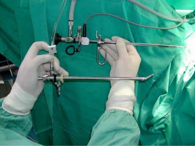 Reseccion transuretral de prostata y sindrome rtup. samantha mejia an…