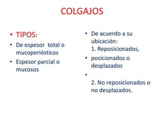COLGAJOS
• TIPOS:
• De espesor total o
mucoperiósticos
• Espesor parcial o
mucosos

• De acuerdo a su
ubicación:
1. Reposicionados,
• posicionados o
desplazados
•
2. No reposicionados o
no desplazados.

 