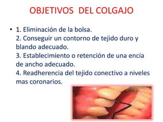 OBJETIVOS DEL COLGAJO
• 1. Eliminación de la bolsa.
2. Conseguir un contorno de tejido duro y
blando adecuado.
3. Establecimiento o retención de una encía
de ancho adecuado.
4. Readherencia del tejido conectivo a niveles
mas coronarios.

 