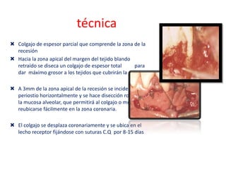 técnica
 Colgajo de espesor parcial que comprende la zona de la
recesión
 Hacia la zona apical del margen del tejido blando
retraído se diseca un colgajo de espesor total
para
dar máximo grosor a los tejidos que cubrirán la raíz.
 A 3mm de la zona apical de la recesión se inciden el
periostio horizontalmente y se hace disección roma de
la mucosa alveolar, que permitirá al colgajo o mucosa
reubicarse fácilmente en la zona coronaria.
 El colgajo se desplaza coronariamente y se ubica en el
lecho receptor fijándose con suturas C.Q por 8-15 días

 