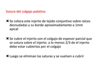 Sutura del colgajo palatino
 Se coloca este injerto de tejido conjuntivo sobre raíces
desnudadas y su borde aproximadamente a 1mm
apical
 Se cubre el injerto con el colgajo de espesor parcial que
se sutura sobre el injerto. a lo menos 2/3 de el injerto
debe estar cubiertos por el colgajo
 Luego se eliminan las saturas y se vuelven a cubrir

 