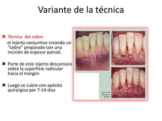 Variante de la técnica
 Técnica del sobre
el injerto conjuntivo creando un
“sobre” preparado con una
incisión de espesor parcial.
 Parte de este injerto descansara
sobre la superficie radicular
hacia el margen
 Luego se cubre con apósito
quirúrgico por 7-14 días

 