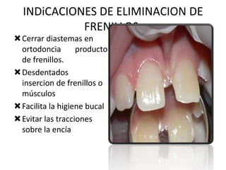 INDiCACIONES DE ELIMINACION DE
FRENILLOS:
Cerrar diastemas en
ortodoncia
producto
de frenillos.
Desdentados
insercion de frenillos o
músculos
Facilita la higiene bucal
Evitar las tracciones
sobre la encía

 