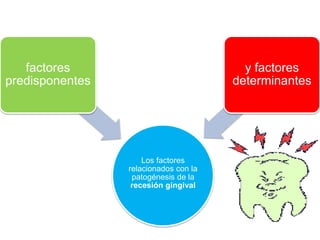 factores
predisponentes

y factores
determinantes

Los factores
relacionados con la
patogénesis de la
recesión gingival

 