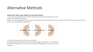 Alternative Methods
Mobile bowel, edge to edge, single layer, interrupted stitches
1. Insert sutures joining the anterior walls. Carefully avoid picking up the back wall. Tie the
knots on the outside of the bowel.
2.When one has completed the anterior wall,turn the bowel over, to bring what was the back wall to the front and insert a series of sutures
to close this, completing the anastomosis
3. If you used stay sutures, cut these out or tie them.
4. Carefully check the mesenteric and antimesenteric edges of the bowel – the junctions of
the anterior and posterior suture lines are most likely to have defects. Insert extra sutures if
necessary.
 