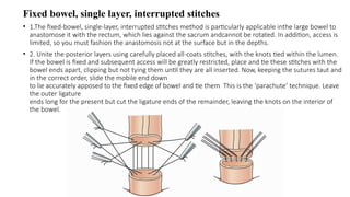 Fixed bowel, single layer, interrupted stitches
• 1.The fixed-bowel, single-layer, interrupted stitches method is particularly applicable inthe large bowel to
anastomose it with the rectum, which lies against the sacrum andcannot be rotated. In addition, access is
limited, so you must fashion the anastomosis not at the surface but in the depths.
• 2. Unite the posterior layers using carefully placed all-coats stitches, with the knots tied within the lumen.
If the bowel is fixed and subsequent access will be greatly restricted, place and tie these stitches with the
bowel ends apart, clipping but not tying them until they are all inserted. Now, keeping the sutures taut and
in the correct order, slide the mobile end down
to lie accurately apposed to the fixed edge of bowel and tie them This is the ‘parachute’ technique. Leave
the outer ligature
ends long for the present but cut the ligature ends of the remainder, leaving the knots on the interior of
the bowel.
 