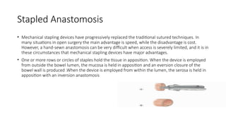 Stapled Anastomosis
• Mechanical stapling devices have progressively replaced the traditional sutured techniques. In
many situations in open surgery the main advantage is speed, while the disadvantage is cost.
However, a hand-sewn anastomosis can be very difficult when access is severely limited, and it is in
these circumstances that mechanical stapling devices have major advantages.
• One or more rows or circles of staples hold the tissue in apposition. When the device is employed
from outside the bowel lumen, the mucosa is held in apposition and an eversion closure of the
bowel wall is produced .When the device is employed from within the lumen, the serosa is held in
apposition with an inversion anastomosis
 