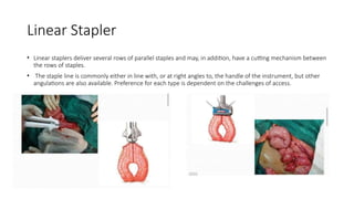 Linear Stapler
• Linear staplers deliver several rows of parallel staples and may, in addition, have a cutting mechanism between
the rows of staples.
• The staple line is commonly either in line with, or at right angles to, the handle of the instrument, but other
angulations are also available. Preference for each type is dependent on the challenges of access.
 