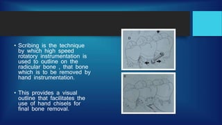 Resective osseous surgery | PPTX