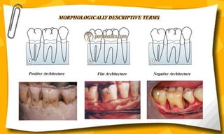 MORPHOLOGICALLY DESCRIPTIVE TERMS
Positive Architecture Negative Architecture
Flat Architecture
 