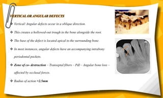 VERTICAL OR ANGULAR DEFECTS
 Vertical/ Angular defects occur in a oblique direction.
 This creates a hollowed-out trough in the bone alongside the root.
 The base of the defect is located apical to the surrounding bone.
 In most instances, angular defects have an accompanying intrabony
periodontal pockets.
 Zone of co- destruction – Transeptal fibers – Pdl – Angular bone loss –
affected by occlusal forces.
 Radius of action >2.5mm
15
 