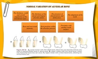 NORMAL VARIATION OF ALVEOLAR BONE
The thickness, width
and crestal
angulation of the
interdental septa .
The thickness of the
facial and lingual
alveolar plates.
The presence of
fenestrations and
dehiscence.
The alignment of the
teeth.
Root and root trunk
anatomy.
Root position within
the alveolar process.
Proximity with
another tooth
surface.
21
 