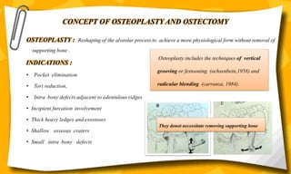 CONCEPT OF OSTEOPLASTY AND OSTECTOMY
OSTEOPLASTY : Reshaping of the alveolar process to achieve a more physiological form without removal of
supporting bone .
INDICATIONS :
• Pocket elimination
• Tori reduction,
• Intra bony defects adjacent to edentulous ridges
• Incipient furcation involvement
• Thick heavy ledges and exostoses
• Shallow osseous craters
• Small intra bony defects
Osteoplasty includes the techniques of vertical
grooving or festooning (ochsenbein,1958) and
radicular blending (carranza, 1984).
They donot necessitate removing supporting bone
 