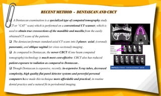 RECENT METHOD - DENTASCAN AND CBCT
 A Dentascan examination is a specialized type of computed tomography study
(CT or “CAT” scan) which is performed on a conventional CT scanner, which is
used to obtain true crosssections of the mandible and maxilla from the easily
obtained CT scans of the patients.
 The dentascan formats standard axial CT scans into 3 planes: axial, (coronal)
panoramic, and oblique sagittal (or cross-sectional) imaging .
 As compared to Dentascan, the newer CBCT (Cone beam computed
tomography) technology is much more cost-effective. CBCT also has reduced
patient exposure to radiation as compared to Dentascan .
 Though Dentascan is expensive, recently, in-expensive X-ray tubes, decreased
complexity, high quality flat panel detector systems and powerful personal
computers have made this technique more affordable and practical, in routine
dental practice and a natural fit in periodontal imaging.
 