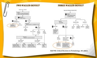TWO WALLED DEFECT THREE WALLED DEFECT
Hall WB. Critical Decisions in Periodontogy. 4th edition
 