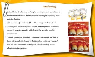 Vertical Grooving
• In health, the alveolar bone and gingiva covering the roots of teeth have a
relative prominence over the interradicular counterpart, especially in the
anterior dentition.
• This creates a self – maintainable architecture of periodontal tissue.
• Another point to be remembered is that the prime objective of periodontal
surgery is to replace a pocket with the selective recession which is
maintainable.
• Vertical grooving or festooning – reduce buccal & lingual thickness of
bone interdentally till the desired depth and later on these are merged
with the bone covering the root surfaces, thereby creating smooth
elevations and depressions.
 
