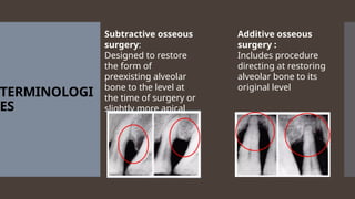 TERMINOLOGI
ES
Subtractive osseous
surgery:
Designed to restore
the form of
preexisting alveolar
bone to the level at
the time of surgery or
slightly more apical
Additive osseous
surgery :
Includes procedure
directing at restoring
alveolar bone to its
original level
 