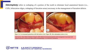 RESECTIVE OSSEOUS SURGERY : Precision Reshaping for Periodontal Health ...