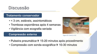 Discussão
• < 3 cm, estáveis, assintomáticos
• Trombose espontânea após 4 semanas
• Vigilância com ecografia seriada
• Pulseira pneumática→ 15-20 minutos após procedimento
• Compressão com sonda ecográfica→ 10-30 minutos
Tratamento conservador
Compressão externa Figura 23: Cauchi, et al.
 