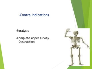 -Contra Indications
-Paralysis
-Complete upper airway
Obstruction
 