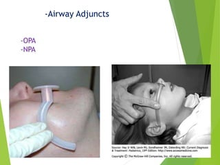 -Airway Adjuncts
-OPA
-NPA
 