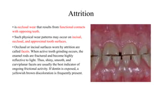 Diagnosis of periodontal disease | PPSX