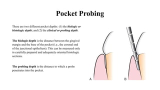 Diagnosis of periodontal disease | PPSX