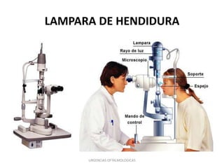 LAMPARA DE HENDIDURA

URGENCIAS OFTALMOLOGICAS

 