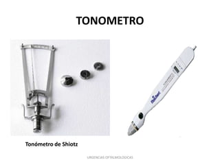TONOMETRO

Tonómetro de Shiotz
URGENCIAS OFTALMOLOGICAS

 