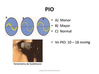 PIO
A

• VN PIO

B

C

• A) Menor
• B) Mayor
• C) Normal

• Vn PIO: 10 – 18 mmHg

Tonómetro de Goldmann
URGENCIAS OFTALMOLOGICAS

 
