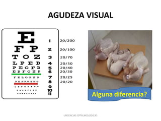 AGUDEZA VISUAL

Alguna diferencia?
URGENCIAS OFTALMOLOGICAS

 