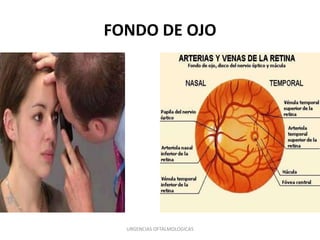 FONDO DE OJO

URGENCIAS OFTALMOLOGICAS

 