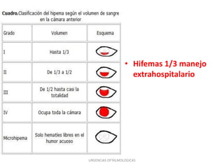 • Hifemas 1/3 manejo
extrahospitalario

URGENCIAS OFTALMOLOGICAS

 
