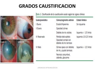 GRADOS CAUSTIFICACION

URGENCIAS OFTALMOLOGICAS

 