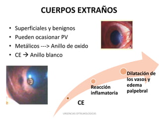 CUERPOS EXTRAÑOS
•
•
•
•

Superficiales y benignos
Pueden ocasionar PV
Metálicos ---> Anillo de oxido
CE  Anillo blanco

Reacción
inflamatoria

CE
URGENCIAS OFTALMOLOGICAS

Dilatación de
los vasos y
edema
palpebral

 