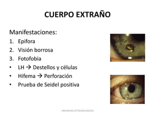 CUERPO EXTRAÑO
Manifestaciones:
1.
2.
3.
•
•
•

Epifora
Visión borrosa
Fotofobia
LH  Destellos y células
Hifema  Perforación
Prueba de Seidel positiva

URGENCIAS OFTALMOLOGICAS

 