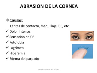 ABRASION DE LA CORNEA
Causas:
Lentes de contacto, maquillaje, CE, etc.
 Dolor intenso
 Sensación de CE
 Fotofobia
 Lagrimeo
 Hiperemia
 Edema del parpado
URGENCIAS OFTALMOLOGICAS

 