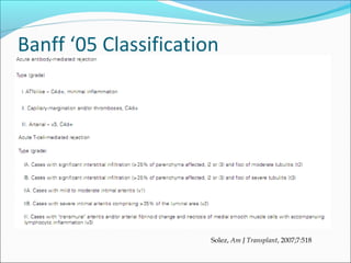 Banff ‘05 Classification
Solez, Am J Transplant, 2007;7:518
 
