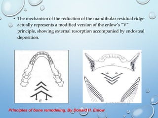 Residual ridge resorption | PPTX