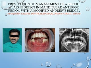 Siberet Ridge Defect Residual ridge resorption | PPTX