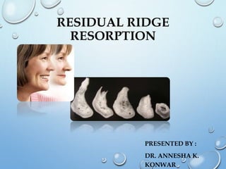 RESIDUAL RIDGE
RESORPTION
PRESENTED BY :
DR. ANNESHA K.
KONWAR
 