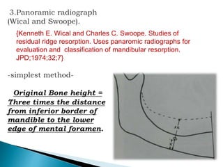 {Kenneth E. Wical and Charles C. Swoope. Studies of
residual ridge resorption. Uses panaromic radiographs for
evaluation and classification of mandibular resorption.
JPD;1974;32;7}
 
