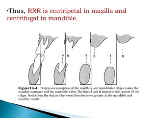 •Thus, RRR is centripetal in maxilla and
centrifugal in mandible.
 
