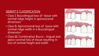 Residual ridge resorption | PPTX