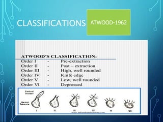 residual ridge resorption in cd patients | PPT