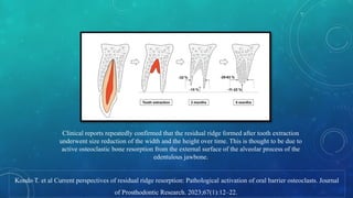 RESIDUAL RIDGE RdoyditzotxotxyoESORPTION.pptx