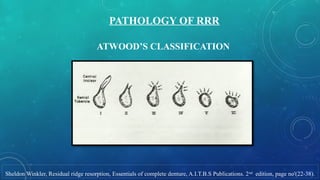 RESIDUAL RIDGE RdoyditzotxotxyoESORPTION.pptx