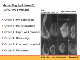 residual ridge resorption seminar final [Autosaved] latest.ppt